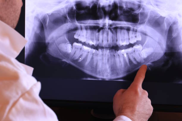 Best Emergency Dental Care for Trauma or Injury in Willits, CA