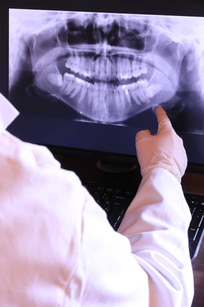 Best Emergency Broken Tooth Repair in Willits, CA