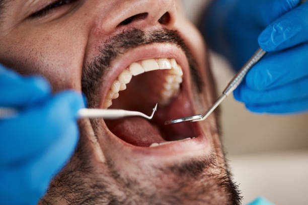 Best Walk-In Emergency Dentist in Willits, CA